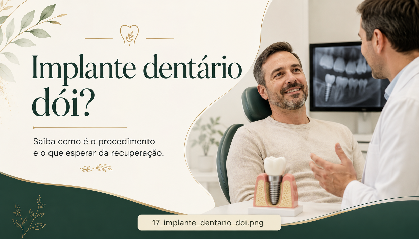 Modelo odontológico mostrando um implante dentário